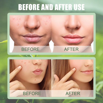 Revitalize Your Skin with the Green Tea Mask Stick - Oil Control & Pore Shrinking Treatment